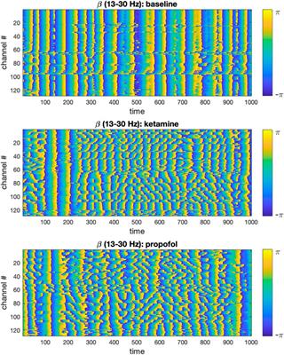 Altered dynamical integration/segregation balance during anesthesia-induced loss of consciousness